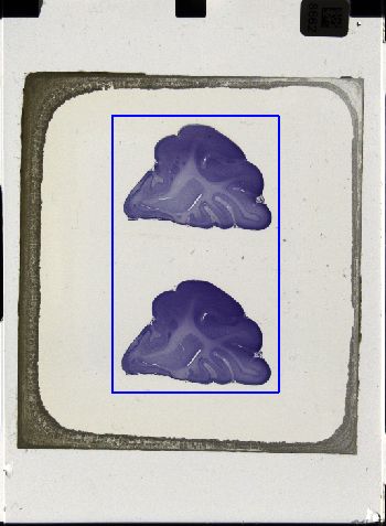 Media type: image; histological serial section;  shows cataloged_item Special Collections 3043